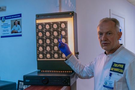 General Director Ryzhenko Serhii shows types of brain injuries at Mechnikov Hospital in Dnipro of Ukraine where wounded soldiers are treated.