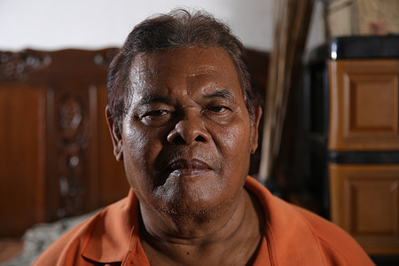 Suparni, 65, a retired East Timorese Operation Seroja war with permanent disability as a result of being shot in the leg by enemy bullets, last rank of Sergeant Two from the Army Strategic Command unit, who is also an athlete with a javelin throwing disability, who has also made the nation proud from a number of medals won at various prestigious Asian Paragames championships, when photographed using a prosthetic leg, inside his house in Wisma Seroja, Bekasi City, a housing complex for veterans of Operation Seroja East Timor. Suparni's serious face shone when he recounted his experience in the Battle of Operation Seroja in East Timor, now known as Timor Leste. Operation Seroja was launched nine days after East Timor proclaimed its independence from Portugal on November 28, 1975. Operation Seroja is also referred to as the Indonesian invasion of East Timor. Because at that time, Indonesia wanted to make East Timor a part of its territory.